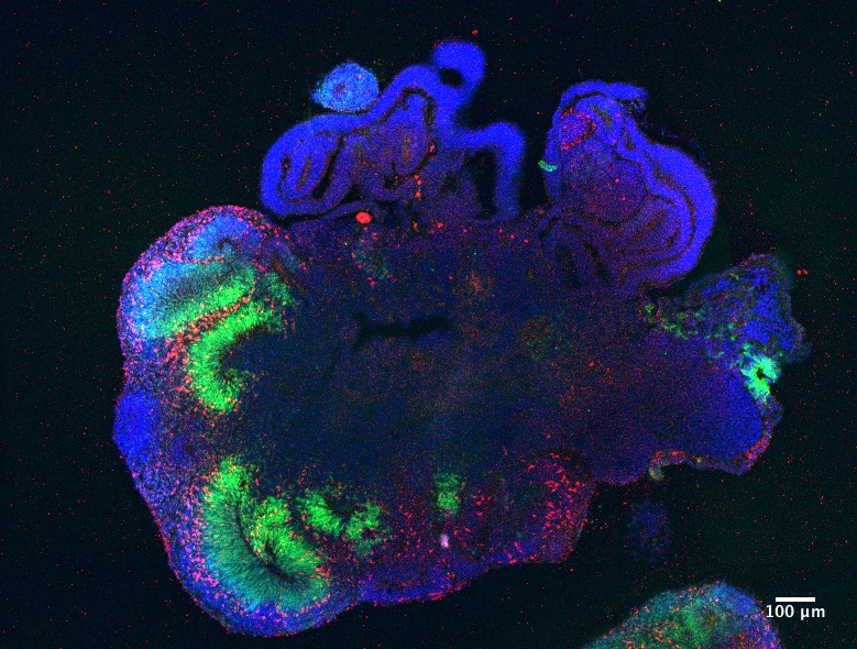 Imagen de Organoide Cerebral